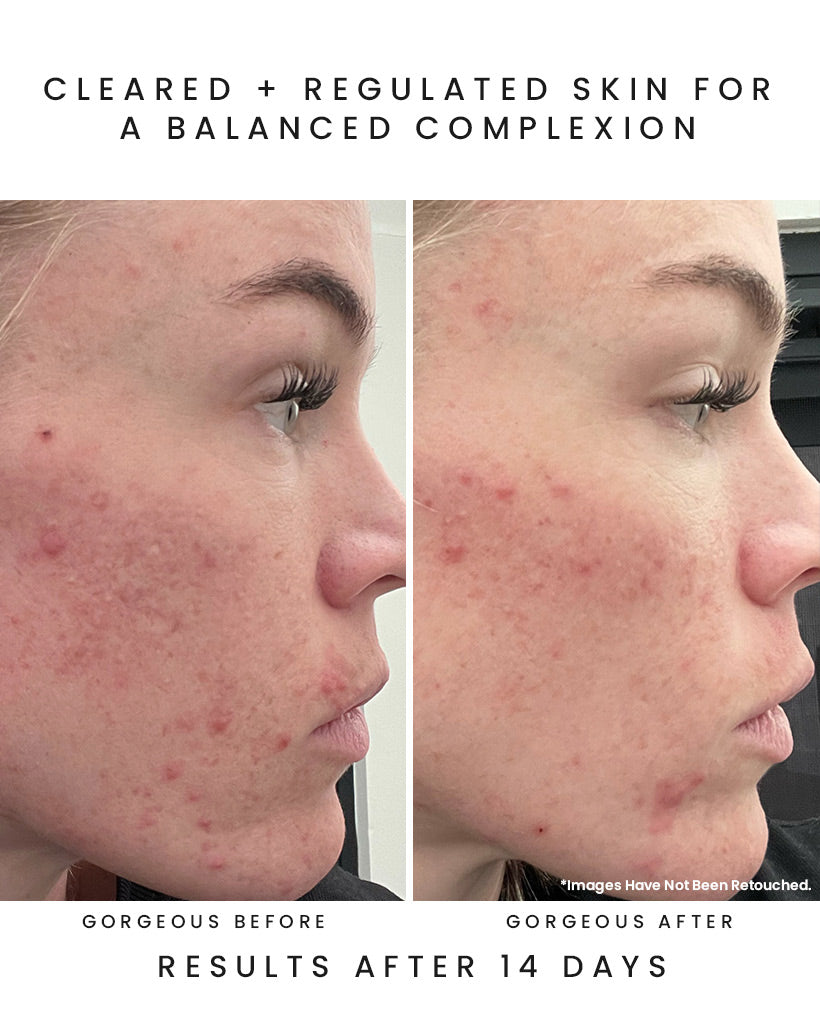 AURORA Superfood Clarity Concentrate