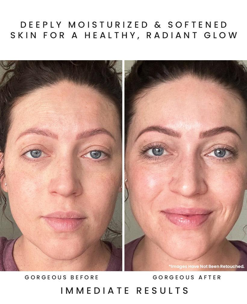 CALYPSO Vitamin C Facial Oil