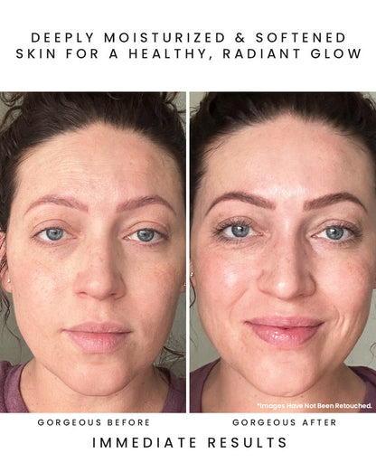 CALYPSO Vitamin C Facial Oil