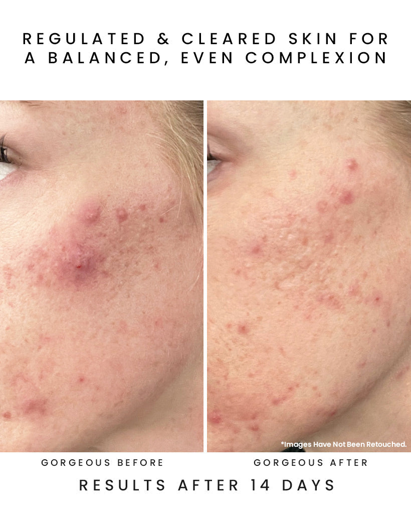 GLOW JUICE 10-Acid Refining Peel