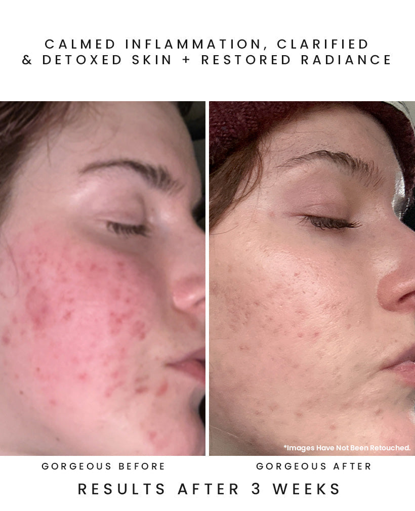 OBSCURA Night Repair Concentrate