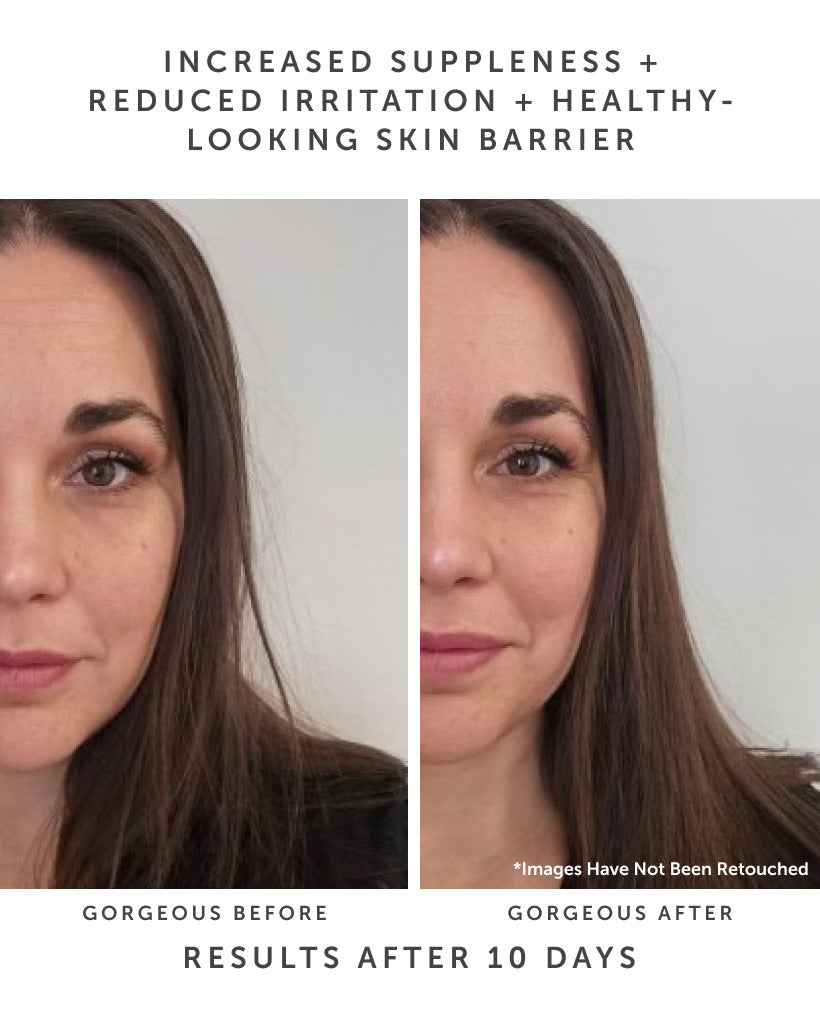 HORIZON Ceramide Repair Serum