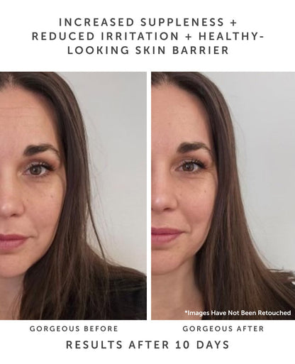 HORIZON Ceramide Repair Serum