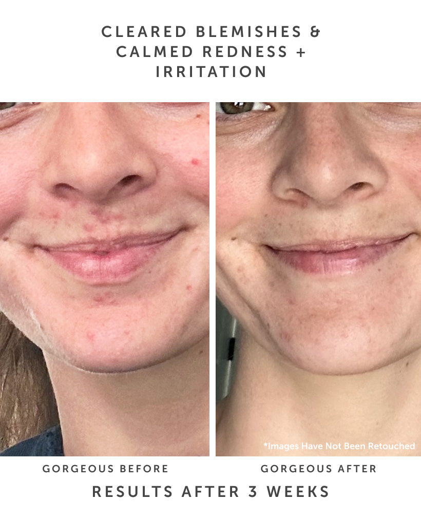 SAMPHIRE BHA Clarifying Serum